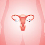 sintomas da endometriose