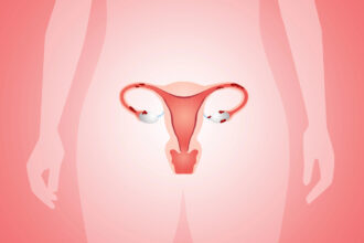 sintomas da endometriose